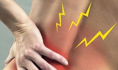 Simptomi lumbalne osteohondroze